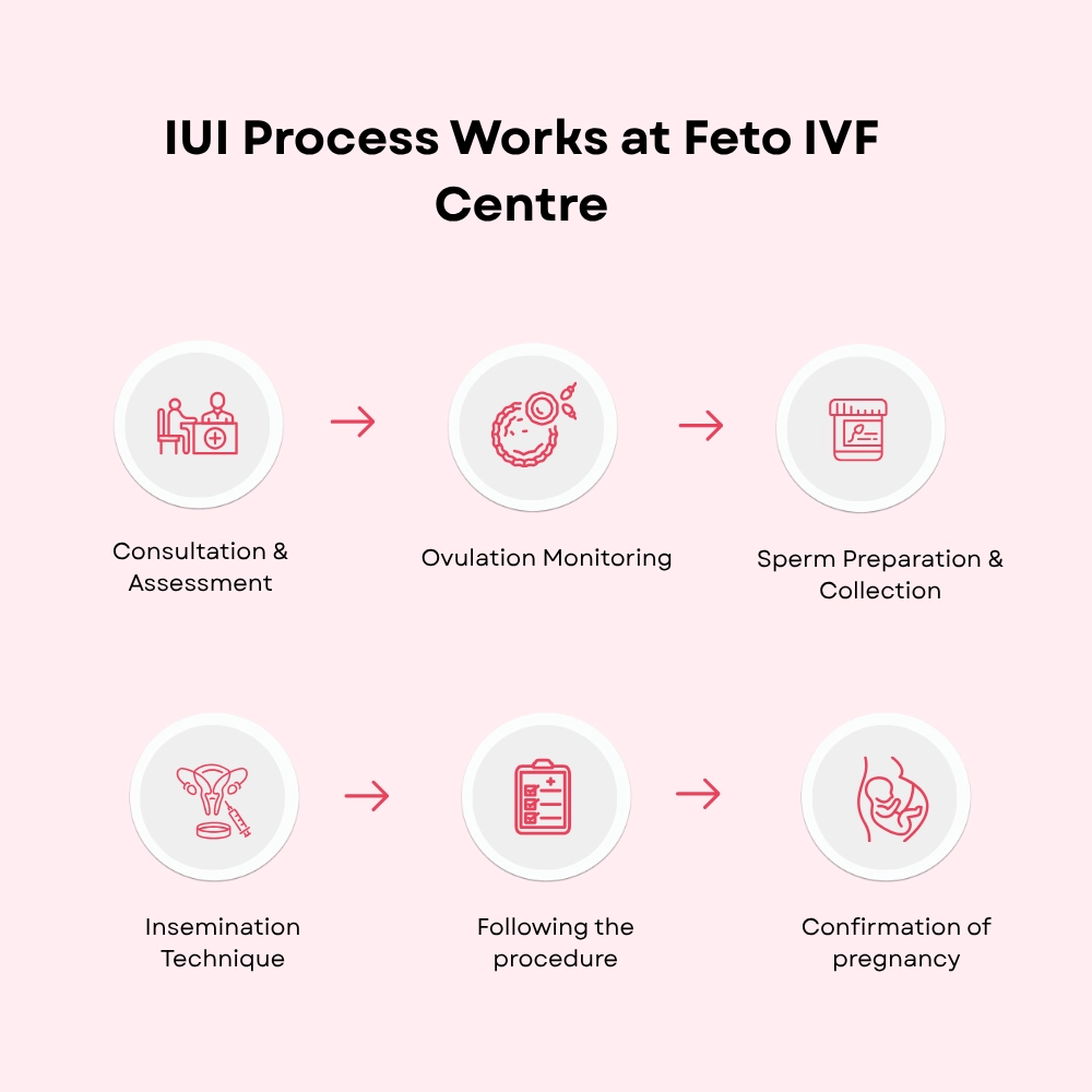 Step-by-step IUI process showing insemination procedure & fertility treatment performed, Coimbatore