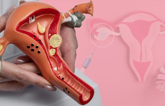 Best ovarian PRP fertility treatments in Coimbatore help improve egg quality & conception chances.