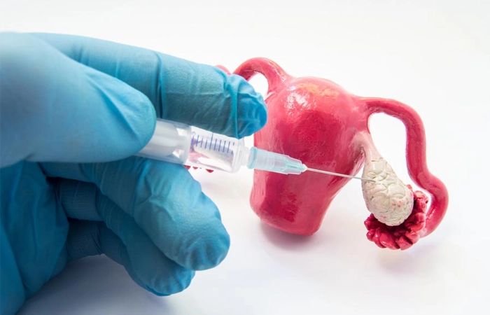 Ovarian stimulation and fertility care in Coimbatore help women improve natural conception chances.