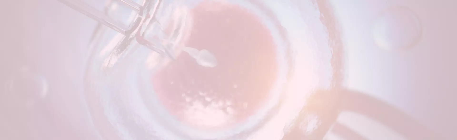 Laser Assisted Hatching
