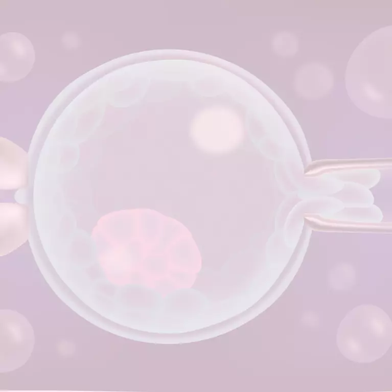 Preimplantation Genetic Testing